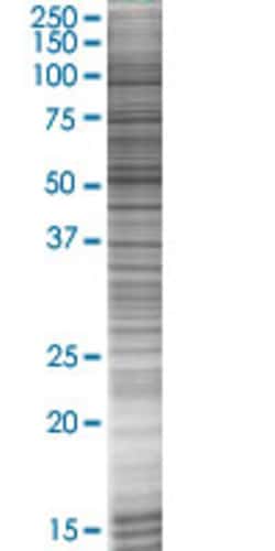 Abnova SPN 293T Cell Transient Overexpression Lysate (Denatured) 100 &mu;l | Buy Online | Abnova&trade; | Fisher Scientific
