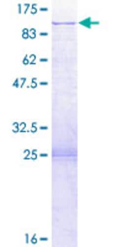 Abnova Human SRP68 Full-length ORF (AAH20238.1, 1 a.a. - 596 a.a.) Recombinant Protein with GST-tag at N-terminal 2 &mu;g | Buy Online | Abnova&trade; | Fisher Scientific