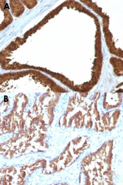 IDH1 Mouse anti-Human, Clone: IDH1/1152, Abnova 100&mu;g; Unlabeled:Antibodies