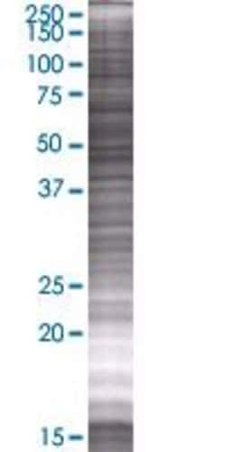 Abnova STCH 293T Cell Transient Overexpression Lysate (Denatured) (T01) 100&mu;L | Buy Online | Abnova&trade; | Fisher Scientific