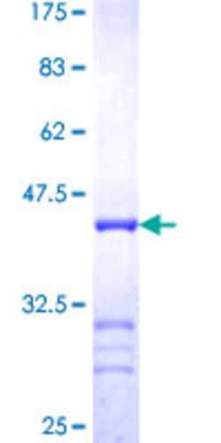 Abnova Human STX4A Partial ORF (NP_004595, 19 a.a. - 119 a.a.) Recombinant Protein with GST-tag at N-terminal 10 ug | Buy Online | Abnova&trade; | Fisher Scientific