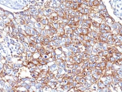 EPCAM Mouse anti-Human, Clone: EGP40/826, Abnova 100&mu;g; Unlabeled:Antibodies,