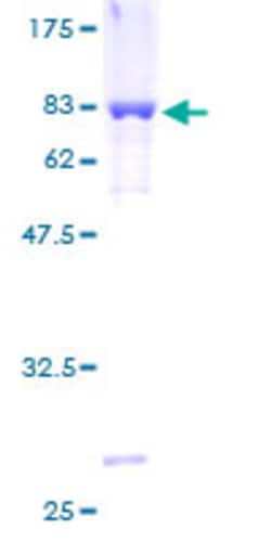 Abnova Human TBXAS1 Full-length ORF (AAH14117, 1 a.a. - 466 a.a.) Recombinant Protein with GST-tag at N-terminal 2 &mu;g | Buy Online | Abnova&trade; | Fisher Scientific