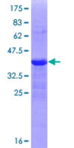Abnova™ Human ZEB1 Partial ORF (NP_110378, 801 a.a. - 900 a.a.) Recombinant Protein with GST-tag at N-terminal