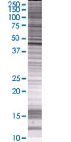 Abnova TDO2 293T Cell Transient Overexpression Lysate (Denatured) 100 &mu;L | Buy Online | Abnova&trade; | Fisher Scientific