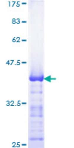 Abnova Human TFAP2B Partial ORF (NP_003212, 73 a.a. - 182 a.a.) Recombinant