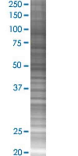 Abnova TFDP1 293T Cell Transient Overexpression Lysate (Denatured) 100 &mu;L | Buy Online | Abnova&trade; | Fisher Scientific