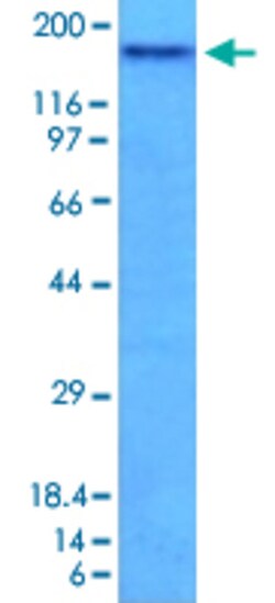 NCAM1 Mouse anti-Human, Clone: NCAM1/795, Abnova 100&mu;g; Unlabeled:Antibodies,