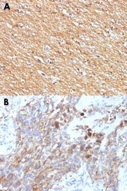 NCAM1 Mouse anti-Human, Clone: NCAM1/795, Abnova 100&mu;g; Unlabeled:Antibodies,