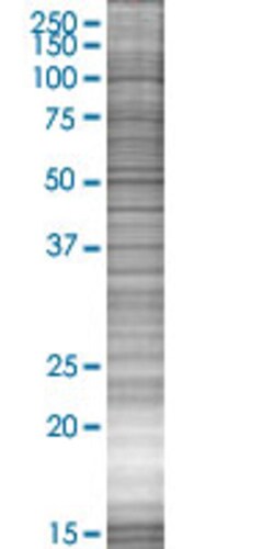 Abnova&trade;&nbsp;TMPRSS2 293T Cell Transient Overexpression Lysate (Denatured)