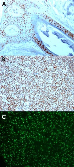NCL Mouse anti-Human, Clone: 364-5, Abnova 100&mu;g; Unlabeled:Antibodies,