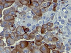 NGFR Mouse anti-Human, Clone: NGFR5, Abnova 100&mu;g; Unlabeled:Antibodies,