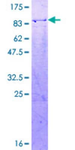 Abnova Human NR2C2 Full-length ORF (AAH51670.1, 1 a.a. - 530 a.a.) Recombinant Protein with GST-tag at N-terminal 2 &mu;g | Buy Online | Abnova&trade; | Fisher Scientific