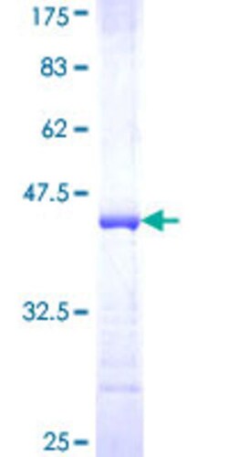 Abnova Human TRAF6 Partial ORF (AAH31052, 413 a.a. - 522 a.a.) Recombinant