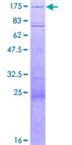 Abnova Human HIRA Full-length ORF (NP_003316.3, 1 a.a. - 1017 a.a.) Recombinant Protein with GST-tag at N-terminal 2 &mu;g | Buy Online | Abnova&trade; | Fisher Scientific