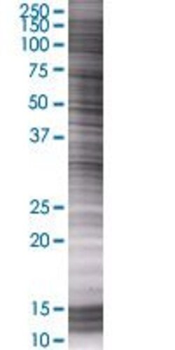 Abnova USP1 293T Cell Transient Overexpression Lysate (Denatured) 100 &mu;L | Buy Online | Abnova&trade; | Fisher Scientific
