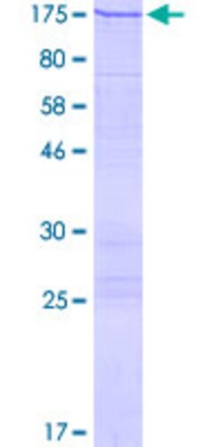 Abnova Human VARS Full-length ORF (AAH12808.1, 1 a.a. - 1264 a.a.) Recombinant Protein with GST-tag at N-terminal 2 &mu;g | Buy Online | Abnova&trade; | Fisher Scientific
