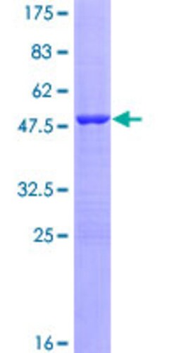 Abnova Human VIP Full-length ORF (AAH09794.1, 1 a.a. - 169 a.a.) Recombinant Protein with GST-tag at N-terminal 25 &mu;g | Buy Online | Abnova&trade; | Fisher Scientific