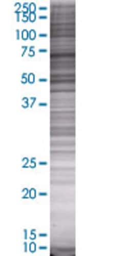 Abnova WEE1 293T Cell Transient Overexpression Lysate (Denatured) (T01) 100 &mu;l | Buy Online | Abnova&trade; | Fisher Scientific