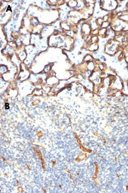 CD34 Mouse anti-Human, Clone: HPCA1/1171, Abnova 100μg; Unlabeled:Antibodies,