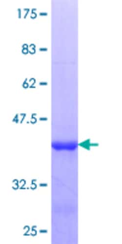 Abnova Human ZNF232 Partial ORF (NP_055334.2, 181 a.a. - 280 a.a.) Recombinant Protein with GST-tag at N-terminal 10 &mu;g | Buy Online | Abnova&trade; | Fisher Scientific