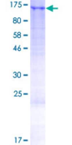 Abnova Human LUZP1 Full-length ORF (AAH51733.1, 1 a.a. - 1026 a.a.) Recombinant Protein with GST-tag at N-terminal 2 &mu;g | Buy Online | Abnova&trade; | Fisher Scientific