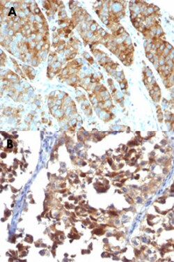 CD63 Mouse anti-Human, Clone: LAMP3/968, Abnova 100&mu;g; Unlabeled:Antibodies,