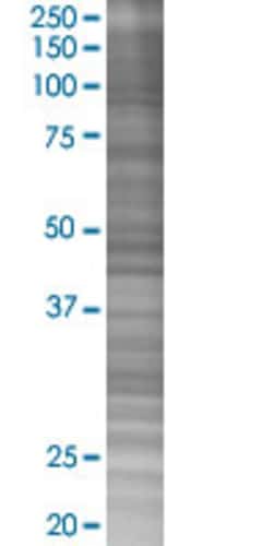 Abnova&trade;&nbsp;CXCR4 293T Cell Transient Overexpression Lysate (Denatured)