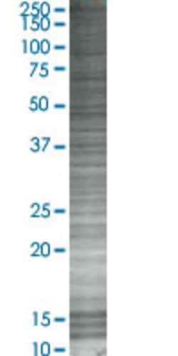 Abnova&trade;&nbsp;BAT4 293T Cell Transient Overexpression Lysate (Denatured) (T02)