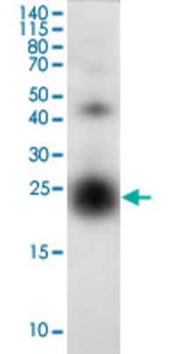 Abnova Human CSF1 (159 a.a.) Full-length Recombinant Protein with His tag expressed in Barley grain 1 mg | Buy Online | Abnova&trade; | Fisher Scientific