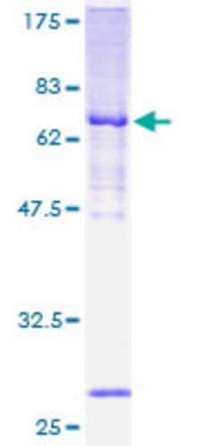 Abnova Human MTERF Full-length ORF (AAH00965, 1 a.a. - 399 a.a.) Recombinant Protein with GST-tag at N-terminal 2 &mu;g | Buy Online | Abnova&trade; | Fisher Scientific