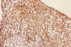 TRPV1 Rabbit anti-Human, Polyclonal , Abnova 100&mu;g; Unlabeled:Antibodies,