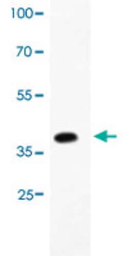 TRPV1 Rabbit anti-Human, Polyclonal , Abnova 100&mu;g; Unlabeled:Antibodies,