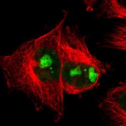 MKI67 Rabbit anti-Human, Polyclonal Antibody, Abnova 100 &mu;L | Buy Online | Abnova | Fisher Scientific