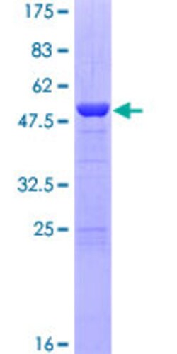 Abnova Human DGCR6 Full-length ORF (NP_005666.2, 1 a.a. - 220 a.a.) Recombinant Protein with GST-tag at N-terminal 10 &mu;g | Buy Online | Abnova&trade; | Fisher Scientific