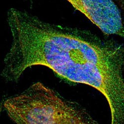 CD79B Rabbit anti-Human, Polyclonal , Abnova 100&mu;L; Unlabeled:Antibodies,
