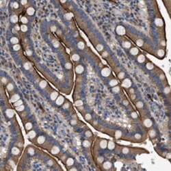 NT5E Rabbit anti-Human, Mouse, Rat, Polyclonal , Abnova 100&mu;L; Unlabeled:Antibodies,