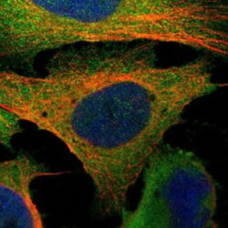 NT5E Rabbit anti-Human, Mouse, Rat, Polyclonal , Abnova 100&mu;L; Unlabeled:Antibodies,