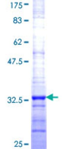 Abnova Human HIST1H4H Partial ORF (NP_003534, 31 a.a. - 103 a.a.) Recombinant Protein with GST-tag at N-terminal 2 &mu;g | Buy Online | Abnova&trade; | Fisher Scientific