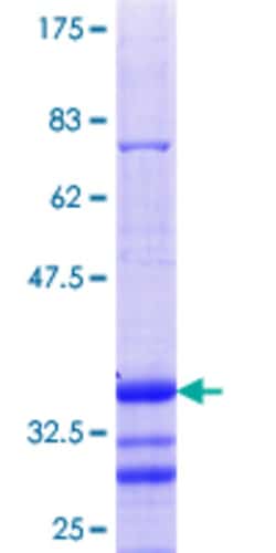 Abnova Human SPOP Partial ORF (NP_001007227.1, 301 a.a. - 374 a.a.) Recombinant Protein with GST-tag at N-terminal 25 &mu;g | Buy Online | Abnova&trade; | Fisher Scientific