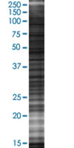 Abnova STX7 293T Cell Transient Overexpression Lysate (Denatured) (T02) 100 &mu;L | Buy Online | Abnova&trade; | Fisher Scientific