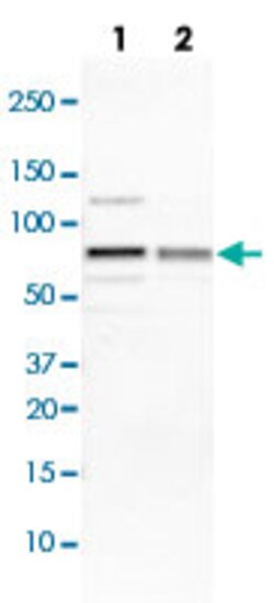IGF2BP3 Rabbit anti-Human, Mouse, Rat, Polyclonal , Abnova 100&mu;L; Unlabeled:Antibodies,