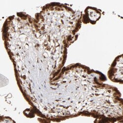 IGF2BP3 Rabbit anti-Human, Mouse, Rat, Polyclonal , Abnova 100&mu;L; Unlabeled:Antibodies,