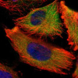 IGF2BP3 Rabbit anti-Human, Mouse, Rat, Polyclonal , Abnova 100&mu;L; Unlabeled:Antibodies,