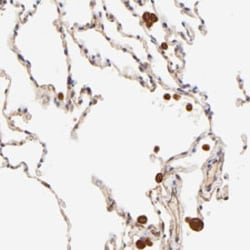 TNFAIP3 Rabbit anti-Human, Polyclonal , Abnova 100 &mu;L | Buy Online | Abnova Corporation | Fisher Scientific