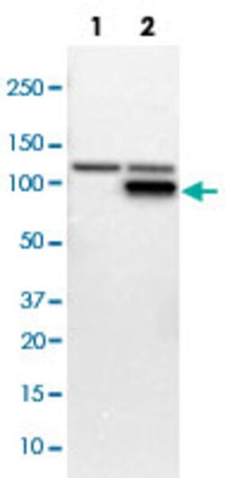 PFKM Rabbit anti-Human, Rat, Polyclonal , Abnova 100&mu;L; Unlabeled:Antibodies,