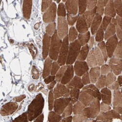 PFKM Rabbit anti-Human, Rat, Polyclonal , Abnova 100&mu;L; Unlabeled:Antibodies,