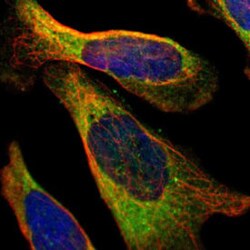 PFKM Rabbit anti-Human, Rat, Polyclonal , Abnova 100&mu;L; Unlabeled:Antibodies,