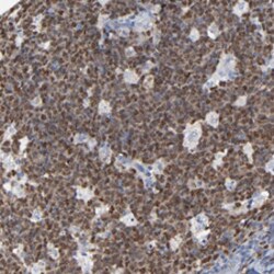 BIRC3 Rabbit anti-Human, Mouse, Rat, Polyclonal , Abnova 100 &mu;L | Buy Online | Abnova Corporation | Fisher Scientific
