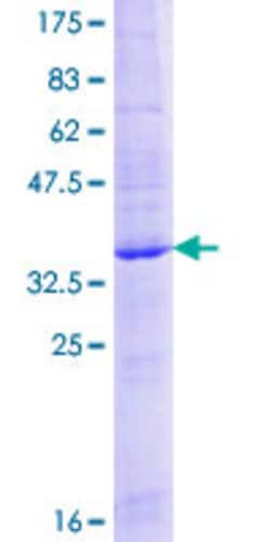 Abnova Human IFITM1 Full-length ORF (AAH00897.1, 1 a.a. - 125 a.a.) Recombinant Protein with GST-tag at N-terminal 25 &mu;g | Buy Online | Abnova&trade; | Fisher Scientific